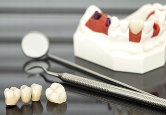 dental crowns sitting next to dental tools and a model of a mouth