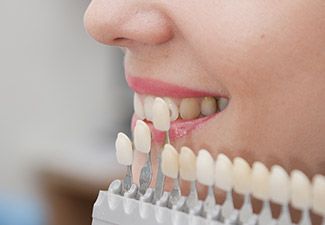 woman using veneer shade chart