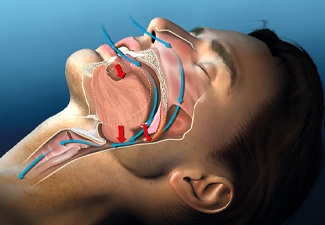 Diagram showing upper airway and causes of snoring