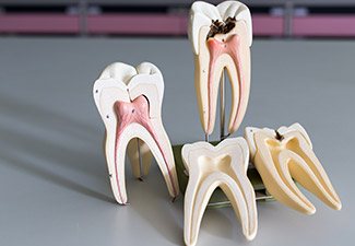 tooth models