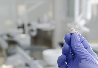 Dentist holding an extracted tooth  