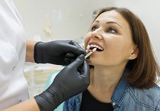 actual patient getting veneer comparison