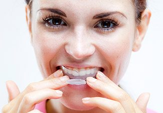 woman using whitening tray